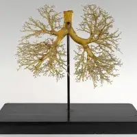 Lung resin cast model