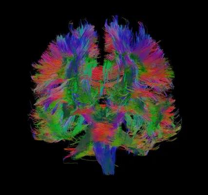 Brain white matter connections of an LBC1936 participant