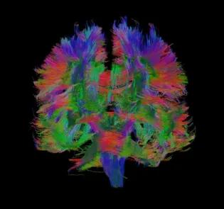 Brain white matter connections of an LBC1936 participant